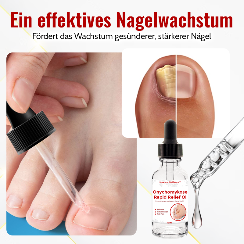 1+1 Gratis | NailSaver™ Onychomycose Rapid Relief Oil 