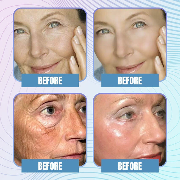 50% Rabatt | Youthful™️ Kollagen Sofort-Boost-Maske