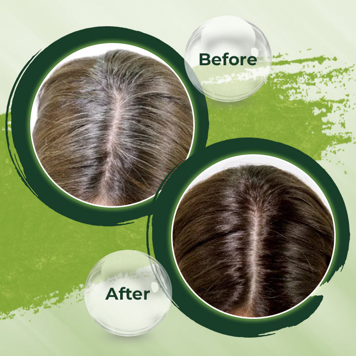 HerbCare™ Shampooreep | 1+1 GRATIS!