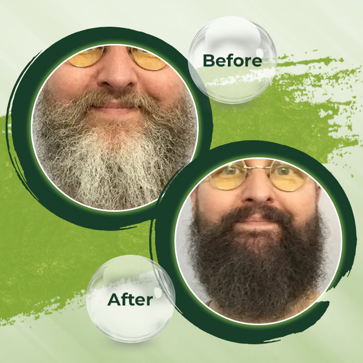 HerbCare™ Shampooreep | 1+1 GRATIS!
