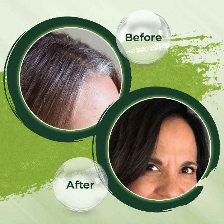 HerbCare™ Shampooreep | 1+1 GRATIS!