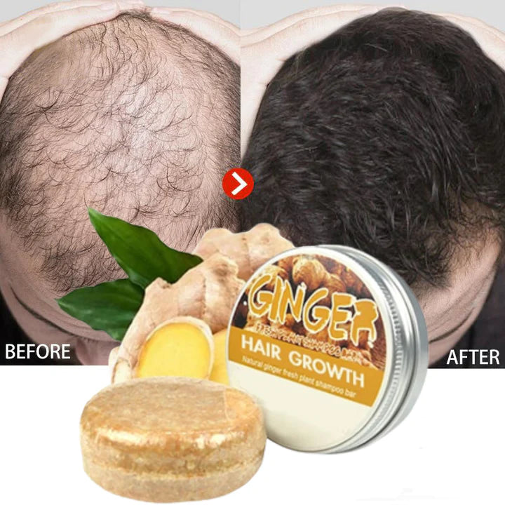 1+1 GRATIS | Gember Haargroei Shampoo Bar 