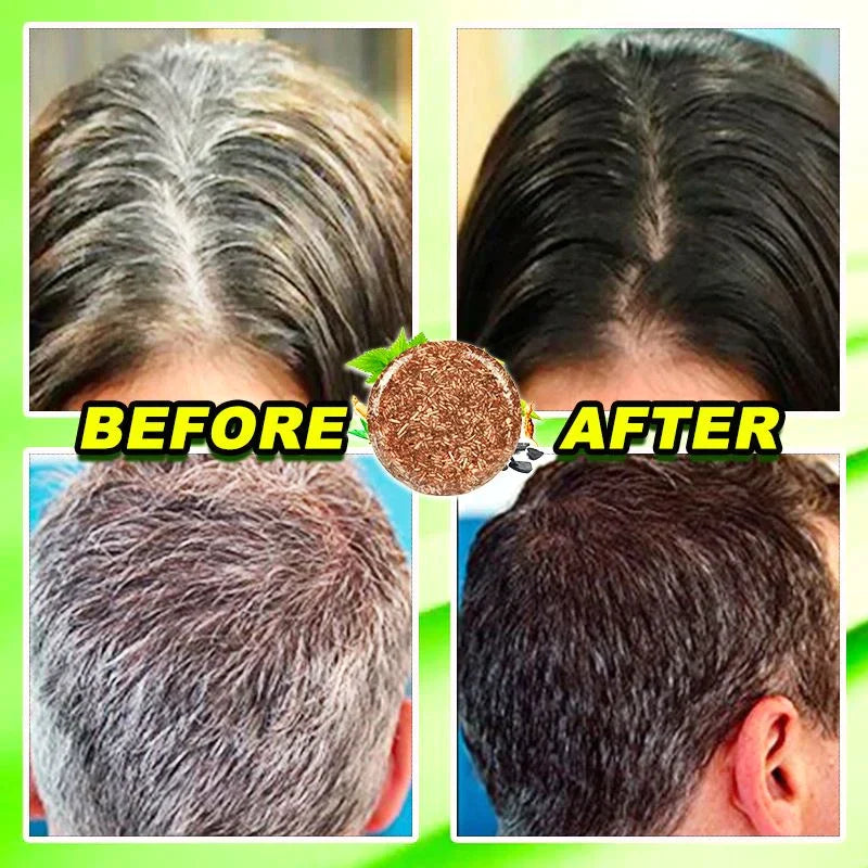 HerbCare™ Shampooreep | 1+1 GRATIS!